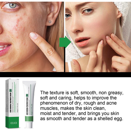 EELHOE Acne Repair Cream